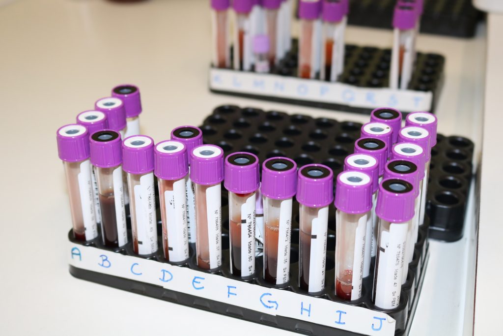 Laboratório do Virvi Ramos passa a coletar exames solicitados por médicos do CES